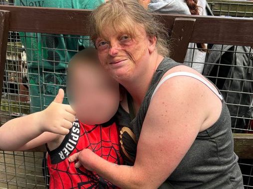 Burns survivor with no hands left 'embarrassed' after being removed from Thorpe Park family rollercoaster ride