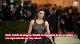 Confesiones de una diva: Kim Kardashian comparte todo sobre sus cirugías, ¿le crees?