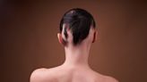 Signs and Symptoms of Alopecia