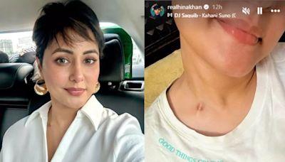 Hina Khan Bravely Shows Her Scars From Chemotherapy: ‘Good Things Coming’