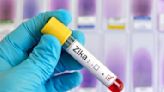 Pune Reports Four New Zika Cases; Total Infections Reach 32