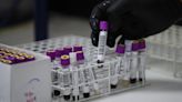 Una vacuna experimental contra el VIH logra activar los anticuerpos en los primeros ensayos con humanos