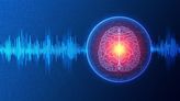 First Results of Magnetic Seizure Therapy for Bipolar Mania