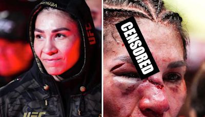 UFC 306 before/after photos of Irene Aldana's massive gory forehead cut are what horror movies are made from