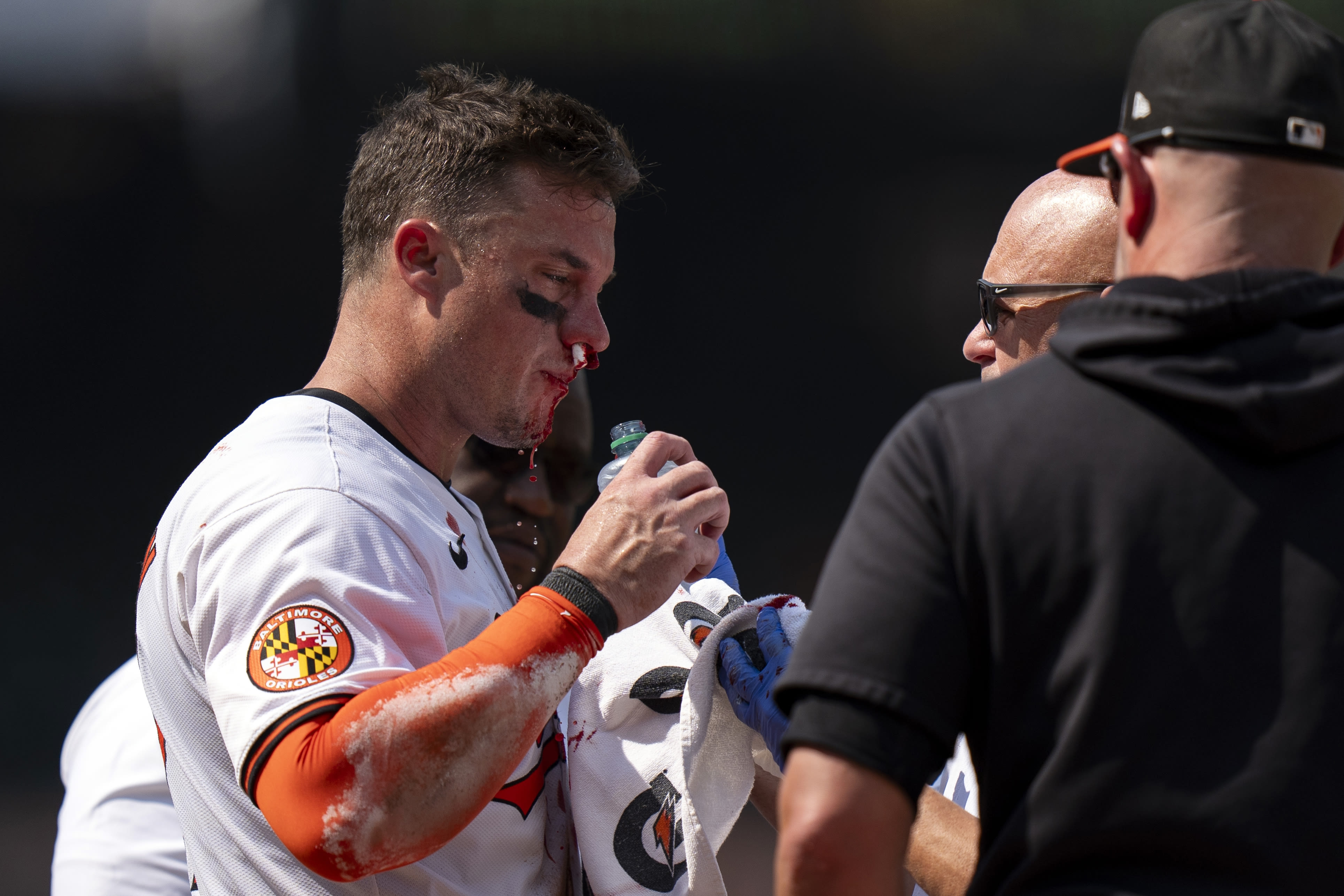 Orioles' James McCann stays in game after taking fastball to his face