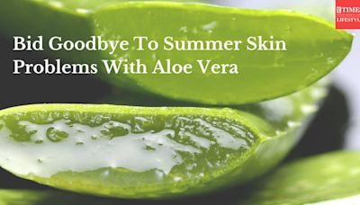 Bid Goodbye To Summer Skin Problems With Aloe Vera | Videos - Times of India Videos