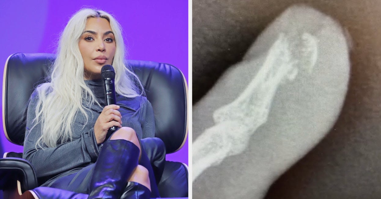 Kim Kardashian Struggles With Finger Injury 'More Painful Than Childbirth' in New 'Kardashians' Teaser