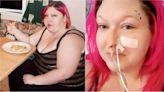 ‘My organs turned to concrete after botched weight loss surgery’