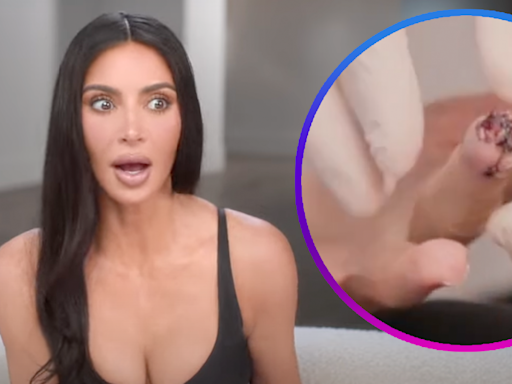 Kim Kardashian Slices Part of Finger: 'More Painful Than Childbirth'