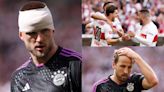 Bloodied Eric Dier puts his body on the line for nothing as beleaguered Bayern given another Bundesliga battering - and wasteful Harry Kane can't save them this time | Goal.com