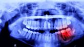 Humans May Be Able to Grow New Teeth Within Just 6 Years