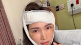 Supermodel Amber Chia to seek neurological care after being hospitalised for a ‘blackout fall’ at home