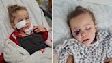 Three-year-old girl suffers dog attack to face