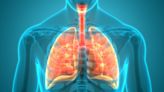 Trials to watch: Four biologics concluding pivotal COPD trials