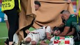 Hungary striker Varga broke several facial bones against Scotland