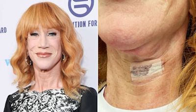 Kathy Griffin Reveals She’s Undergone Second Vocal Cord Surgery: ‘Worth It If I Get Some of My Voice Back’