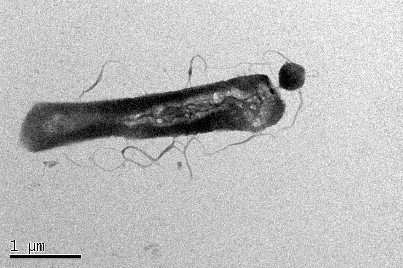 Archaea can be 'picky eaters': Study shows a group of parasitic microbes can change host metabolism