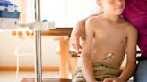 My son needed a feeding tube—when it’s not just picky eating