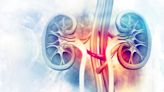 AVEO Oncology kidney cancer combo fails at Phase III