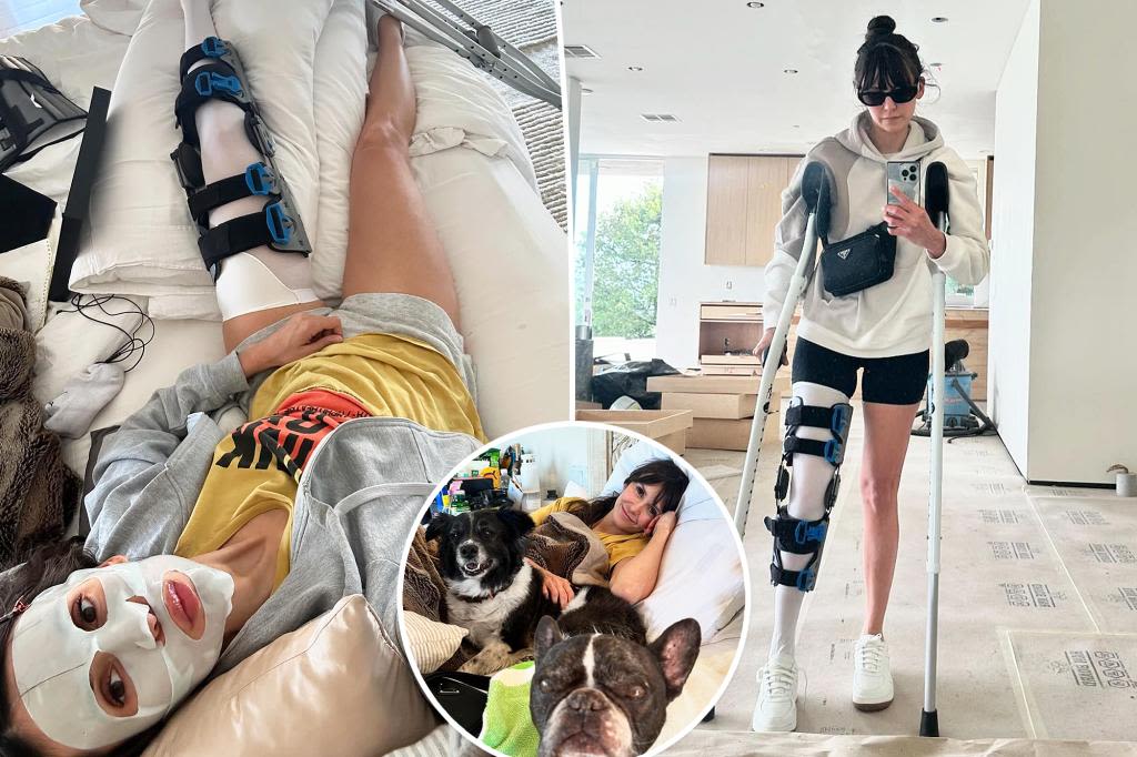 Nina Dobrev shows off injured leg following bike accident: ‘Life looks a lil different lately’