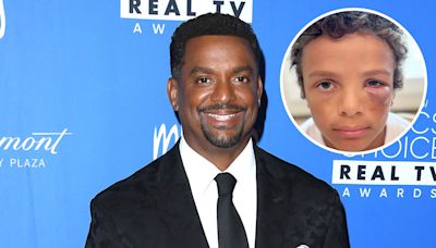 Alfonso Ribeiro Gives Update After Son AJ Is Hit in the Eye With Baseball During Practice