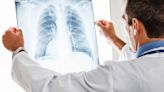 Amgen/AstraZeneca Say Asthma Drug Shows Activity In Another Lung Disease Across Broad Patient Population