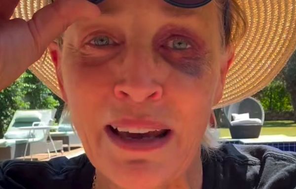 Sharon Stone Shows Off Shiner To Reassure Concerned Fans: 'I Know You're All Worried'