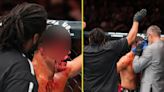 UFC fans offer rare praise to cageside doctor as sickening cut leads to stoppage