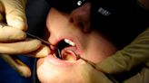 Minister to be challenged over plan to boost dentistry