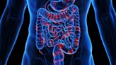 Loss of Anti-TNF Treatment Response Common in Crohn's Disease