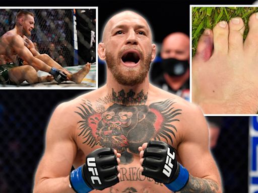 Conor McGregor reveals he went up a shoe size after nightmare UFC toe injury