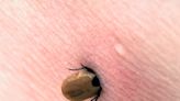 Tick-borne diseases are back. Here's the best way to check for tick bites this summer.