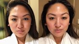 I Let a Facialist Electrocute My Face for Better Cheekbones and It Actually Worked