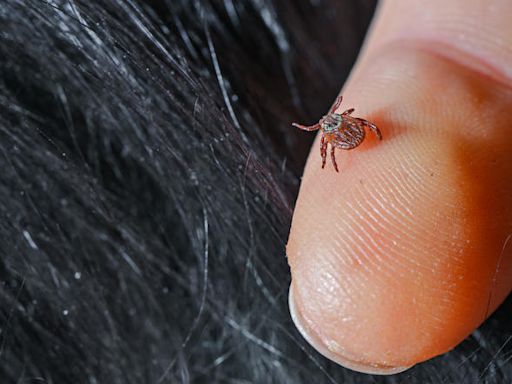 What do ticks look like? How to spot and get rid of them, according to experts - WDEF