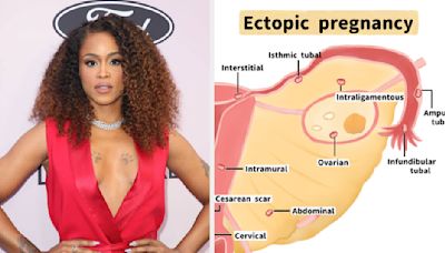 Eve Revealed That She Had An Ectopic Pregnancy: "I Don't Know Why I Lied To Everyone On Set And Said ...