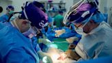 Investigadores reportan el caso más largo de un trasplante exitoso de un riñón de cerdo a un humano