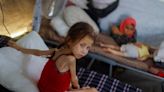 Medics aim to screen thousands of Gaza children for malnutrition