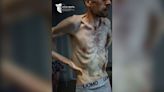 Photos of released Ukrainian prisoners of war show emaciated bodies in ‘horrifying’ condition