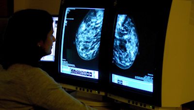 Breast cancer drug not recommended for NHS use after price talks break down