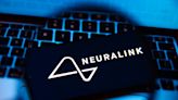 Neuralink Co-Founder Might’ve Left Due to Safety Concerns Over Chip Implantation