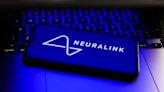 Musk’s Neuralink Hopes to Implant Computer in Human Brain in Six Months