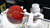 Antibiotic resistance: microbiologists turn to new technologies in the hunt for solutions – podcast