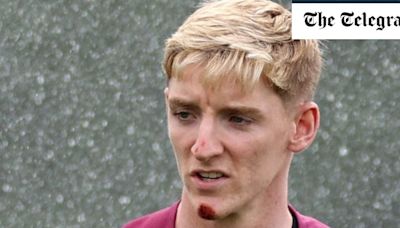 Anthony Gordon grazes face after falling off bike with England