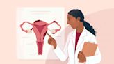 Theories About Endometriosis Causes