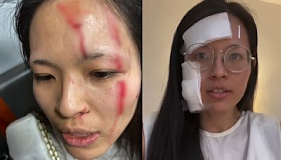 Asian woman 'needs her city back' after violent attack in NYC