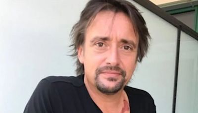 Richard Hammond needs another operation 'to get a new knee' in health update