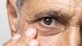 Salud de los ojos: Experta explica lo que seguro no sabes del glaucoma