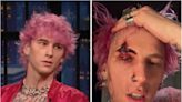 Machine Gun Kelly explains why he smashed a Champagne flute over his head