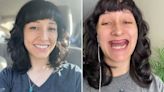 Woman can finally smile after teeth rotted away and being forced to get dentures