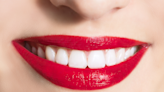 Amazon is having a one-day sale on SmileDirectClub teeth-whitening products: Save up to $15!